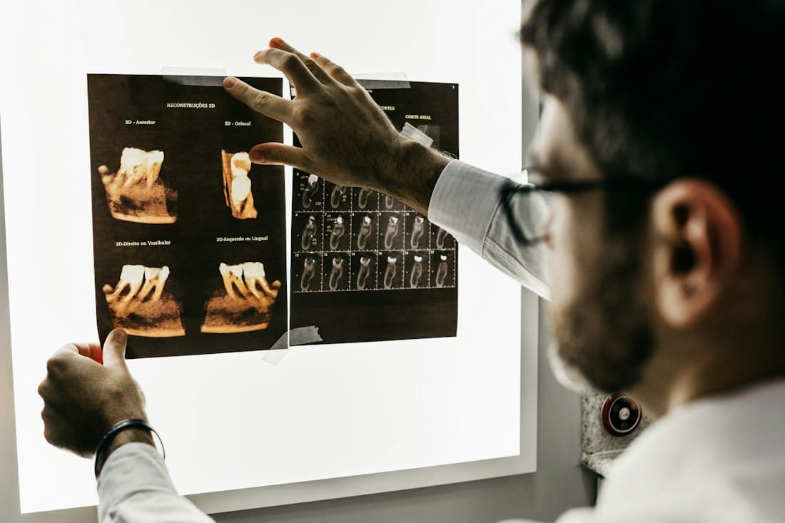 Dentist checking dental X-rays